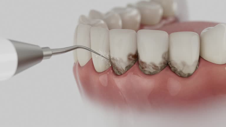 Trusted Root Canal Treatment service in Lawson, MO - Dentist Open Now